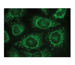 HXK II Antibody (B-8) | SCBT - Santa Cruz Biotechnology
