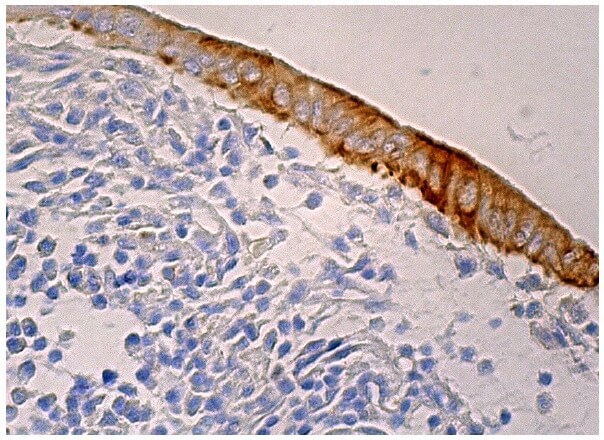 HXK II Antibody (B-8) | SCBT - Santa Cruz Biotechnology
