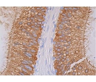 HXK II Antibody (B-8) | SCBT - Santa Cruz Biotechnology