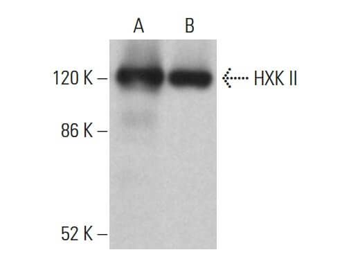 HXK II Antibody (B-8) | SCBT - Santa Cruz Biotechnology