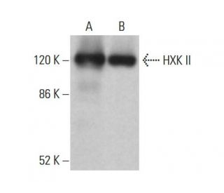 western blotting image from recommended HXK II (B-8) monoclonal antibody replacement. Image 377583