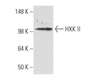 HXK II Antibody (1A7) - Western Blotting - Image 47897