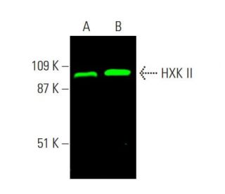 HXK II Antibody (B-8) - Western Blotting - Image 377801 