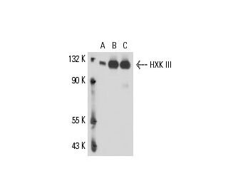 HXK III Antibody (A-9) - Western Blotting - Image 16312 