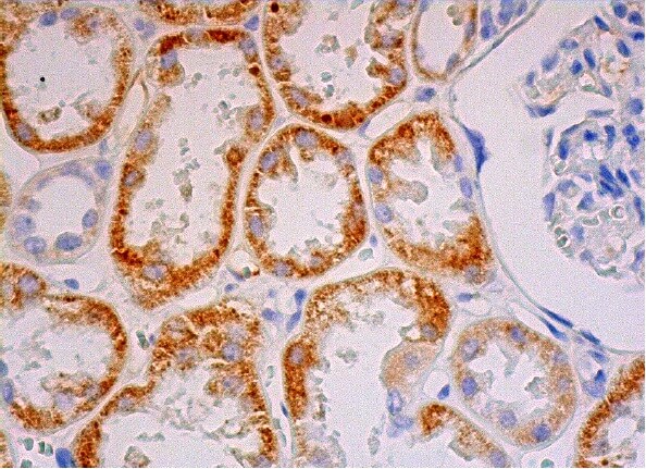 HYAL1 Antibody (1D10) | SCBT - Santa Cruz Biotechnology