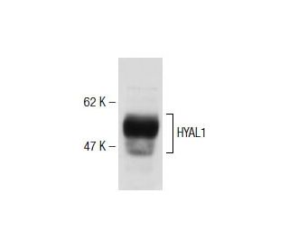 Brilliant Violet 421 anti-mouse CD11c Antibody anti-CD11c - N418