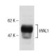 HYAL1 Antibody (1D10) - Western Blotting - Image 137487 