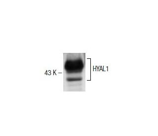 HYAL1 Antibody (4F9) - Western Blotting - Image 137489