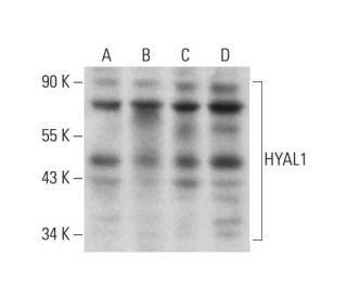 HYAL1 Antibody (F-10) - Western Blotting - Image 325193