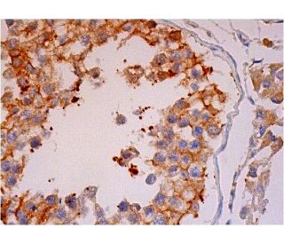 HYAL3 Antibody (E-11) - Immunohistochemistry - Image 293438 