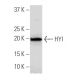 HYI Antibody (R-11) - Western Blotting - Image 33865