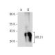 HYLS1 Antibody (D-9) - Western Blotting - Image 158378
