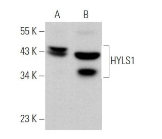 HYLS1 Antibody (E-3) - Western Blotting - Image 369832 