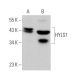 HYLS1 Antibody (E-3) - Western Blotting - Image 369832 