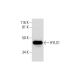 HYLS1 Antibody (F-12) - Western Blotting - Image 295977
