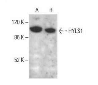 HYLS1 Antibody (F-12) - Western Blotting - Image 376201 