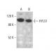HYLS1 Antibody (F-12) - Western Blotting - Image 376201 