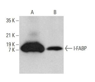 I-FABP Antibody (E-9) - Western Blotting - Image 376585 