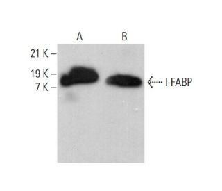 I-FABP Antibody (G-1) - Western Blotting - Image 377050 
