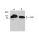 I-FABP Antibody (G-1) - Western Blotting - Image 377050 