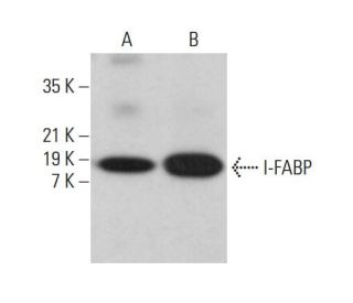 I-FABP Antibody (G-5) - Western Blotting - Image 382783 