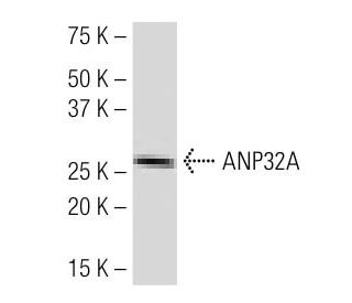 ANP32A Antibody (A-182) - Western Blotting - Image 34140 