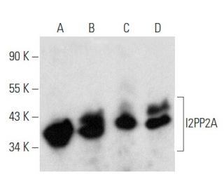western blotting image from recommended I2PP2A (F-9) monoclonal antibody replacement. Image 354328