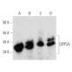 western blotting image from recommended I2PP2A (F-9) monoclonal antibody replacement. Image 354328