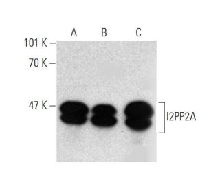 I2PP2A Antibody (F-9) - Western Blotting - Image 136095 