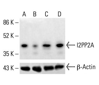 I2PP2A Antibody (F-9) - Western Blotting - Image 412813