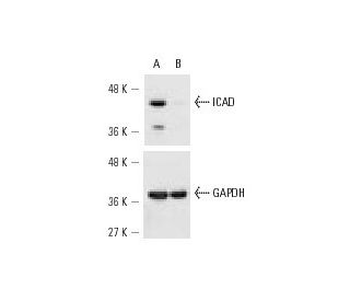 ICAD siRNA (h): sc-35624. Western blot analysis of ICAD expression in non-transfected control (A) and ICAD siRNA transfect 