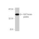 ICAT Antibody (5C6) - Western Blotting - Image 350245