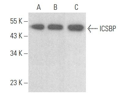 ICSBP Antibody (E-9) | SCBT - Santa Cruz Biotechnology