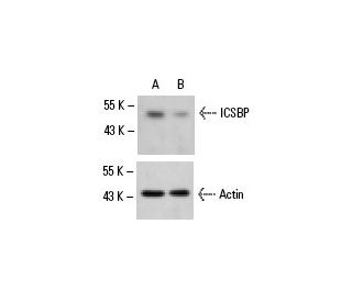 ICSBP siRNA (h): sc-35630. Western blot analysis of ICSBP expression in non-transfected control (A) and ICSBP siRNA transf 