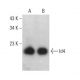 western blotting image from recommended Id4 (B-5) monoclonal antibody replacement. Image 376222