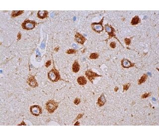 IDS Antibody (B-5) - Immunohistochemistry - Image 380095 