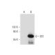 IDS Antibody (E-4) - Western Blotting - Image 138335