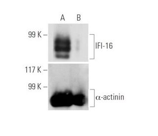 IFI-16 siRNA (h): sc-35633. Western blot analysis of IFI-16 expression in non-transfected control (A) and IFI-16 siRNA tra 