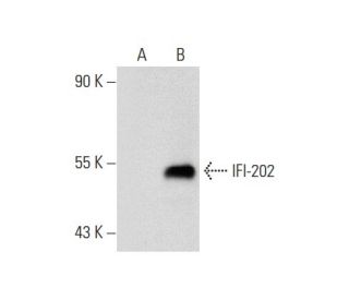 IFI-202 Antibody (F-7) - Western Blotting - Image 72906Each CRISPR/Cas9 Knockout (KO) Plasmid product consists of a pool of 3 plasmids designed to ensure identification and cleavage of a specific gene for maximum knockout efficiency. Each plasmid encodes a unique 20 nt sequence derived from the GeCKO (v2) library. 