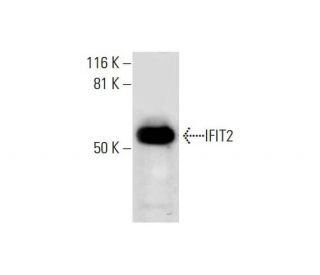 IFIT2 Antibody (F-12) - Western Blotting - Image 291833 