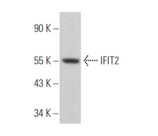 IFIT2 Antibody (F-12) - Western Blotting - Image 364198