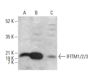 western blotting image from recommended IFITM1/2/3 (F-12) monoclonal antibody replacement. Image 381346