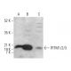 western blotting image from recommended IFITM1/2/3 (F-12) monoclonal antibody replacement. Image 381346