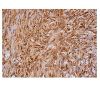 immunohistochemistry image from recommended IFN-&alpha; (F-7) monoclonal antibody replacement. Image 350222