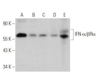 IFN-α/βRα Antibody (H-11) - Western Blotting - Image 360159Each CRISPR/Cas9 Knockout (KO) Plasmid product consists of a pool of 3 plasmids designed to ensure identification and cleavage of a specific gene for maximum knockout efficiency. Each plasmid encodes a unique 20 nt sequence derived from the GeCKO (v2) library.