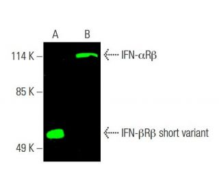 IFN-α/βRβ Antibody (F-7) - Western Blotting - Image 386986