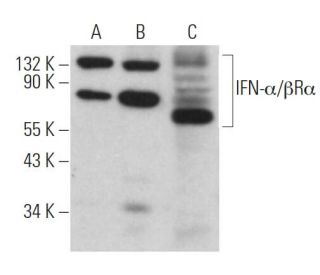 IFN-&alpha;/&beta;R&alpha; Antibody (E-12) - Western Blotting - Image 362139 