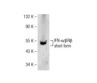 IFN-&alpha;/&beta;R&beta; Antibody (D-6) - Western Blotting - Image 141693