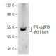 IFN-α/βRβ Antibody (D-6) - Western Blotting - Image 141693
