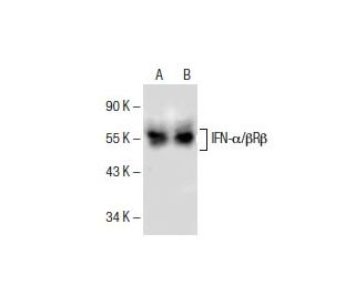 western blotting image from recommended IFN-&alpha;/&beta;R&beta; (G-4) monoclonal antibody replacement. Image 154942